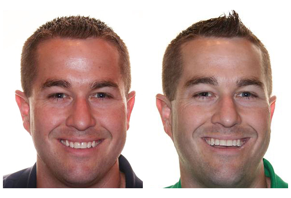 The Center for Advanced Dental Care, PLLC