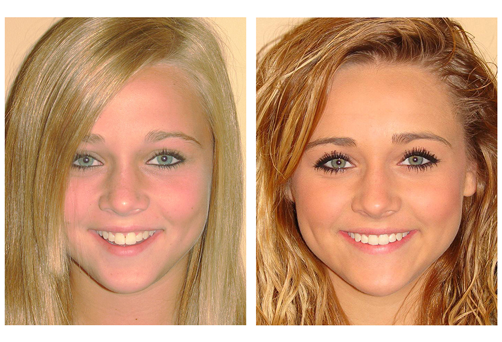 The Center for Advanced Dental Care, PLLC