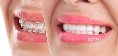 The Center for Advanced Dental Care, PLLC | Night Guards, Oral Cancer Screening and Dentures
