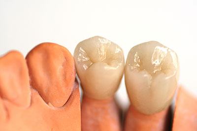 The Center for Advanced Dental Care, PLLC | Emergency Treatment, Invisalign reg  and Dentures