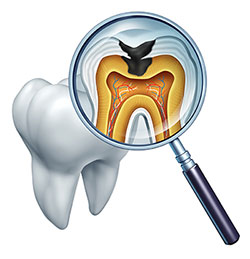 The Center for Advanced Dental Care, PLLC | CEREC, Dental Cleanings and Oral Cancer Screening