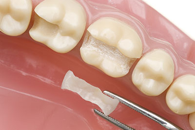 The Center for Advanced Dental Care, PLLC | CBCT, Dental Sealants and ZOOM  Whitening