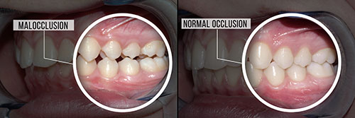 The Center for Advanced Dental Care, PLLC | Oral Exams, Crowns and Full Mouth Reconstruction