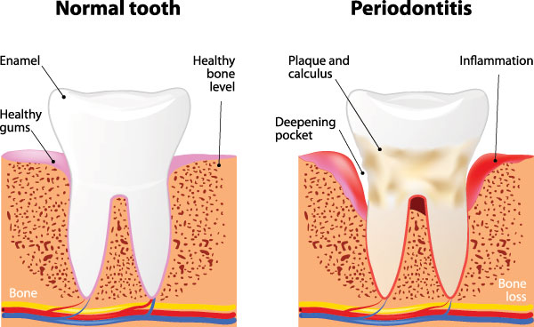 The Center for Advanced Dental Care, PLLC | CEREC, Fluoride Treatment and Cosmetic Dentistry