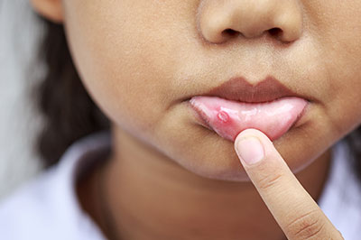 The Center for Advanced Dental Care, PLLC | Ceramic Crowns, Invisalign reg  and TMJ Disorders