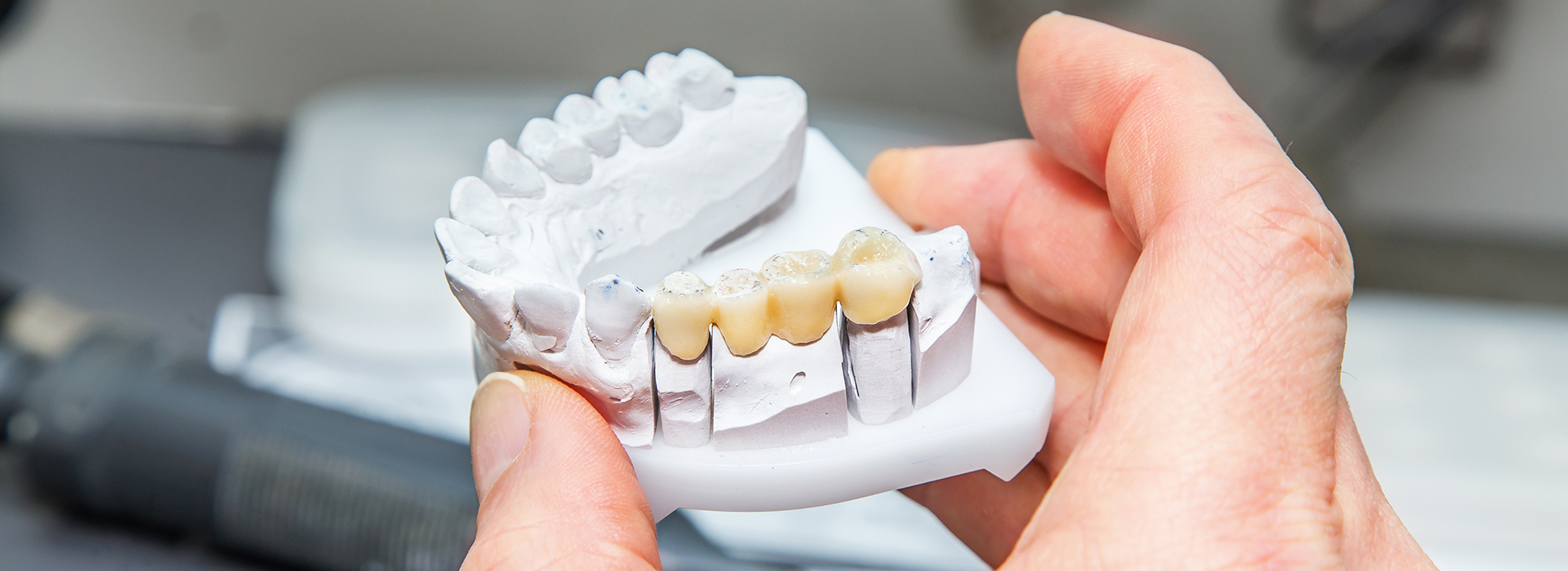 The Center for Advanced Dental Care, PLLC | Fluoride Treatment, Veneers and ZOOM  Whitening