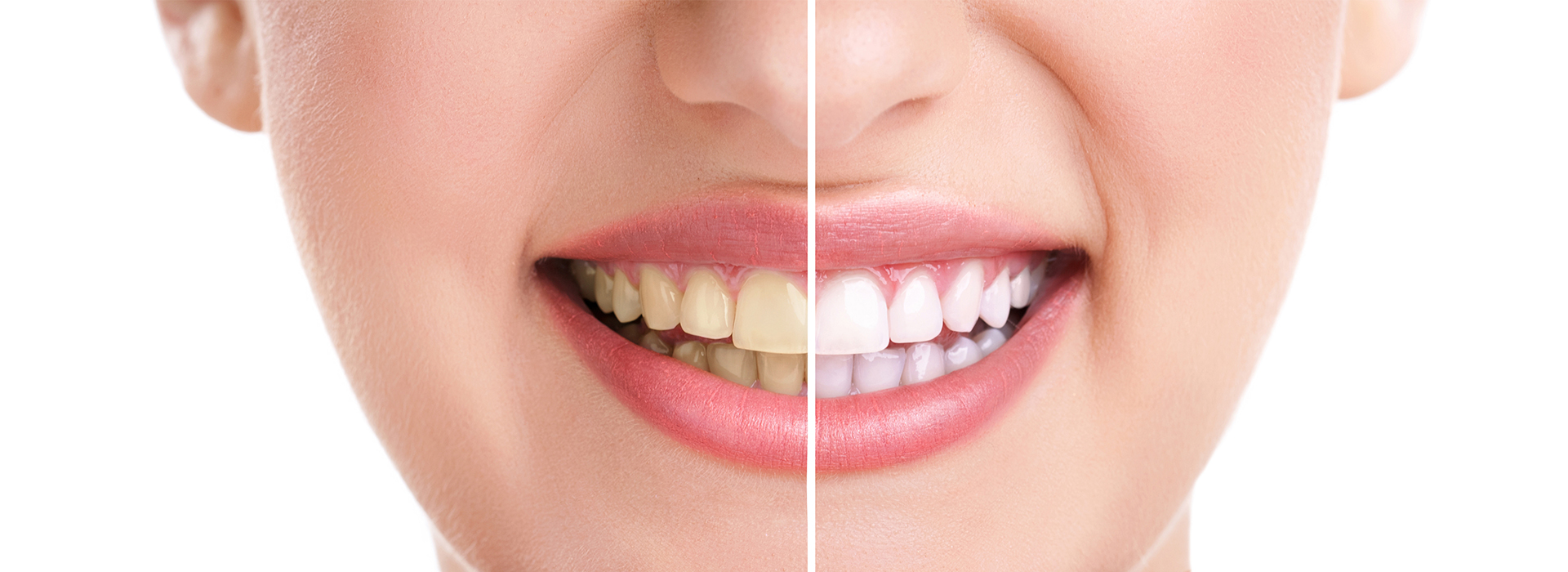 The Center for Advanced Dental Care, PLLC | Dental Bridges, Laser Dentistry and TMJ Disorders