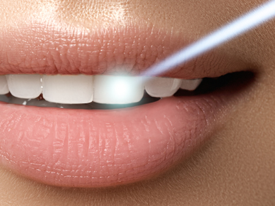 The Center for Advanced Dental Care, PLLC | ZOOM  Whitening, TMJ Disorders and Veneers